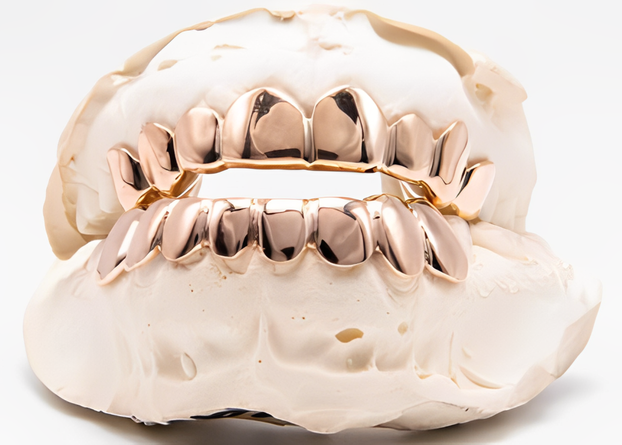 THE KODAK - ROSE GOLD 16 TEETH